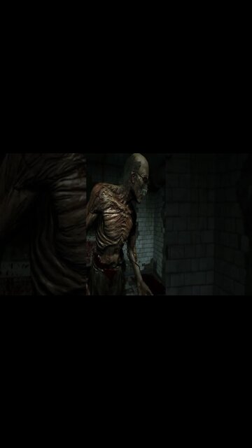 Outlast - The Doctor Took My Philangies!