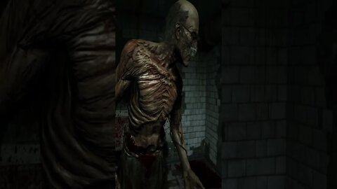 Outlast - The Doctor Took My Philangies!