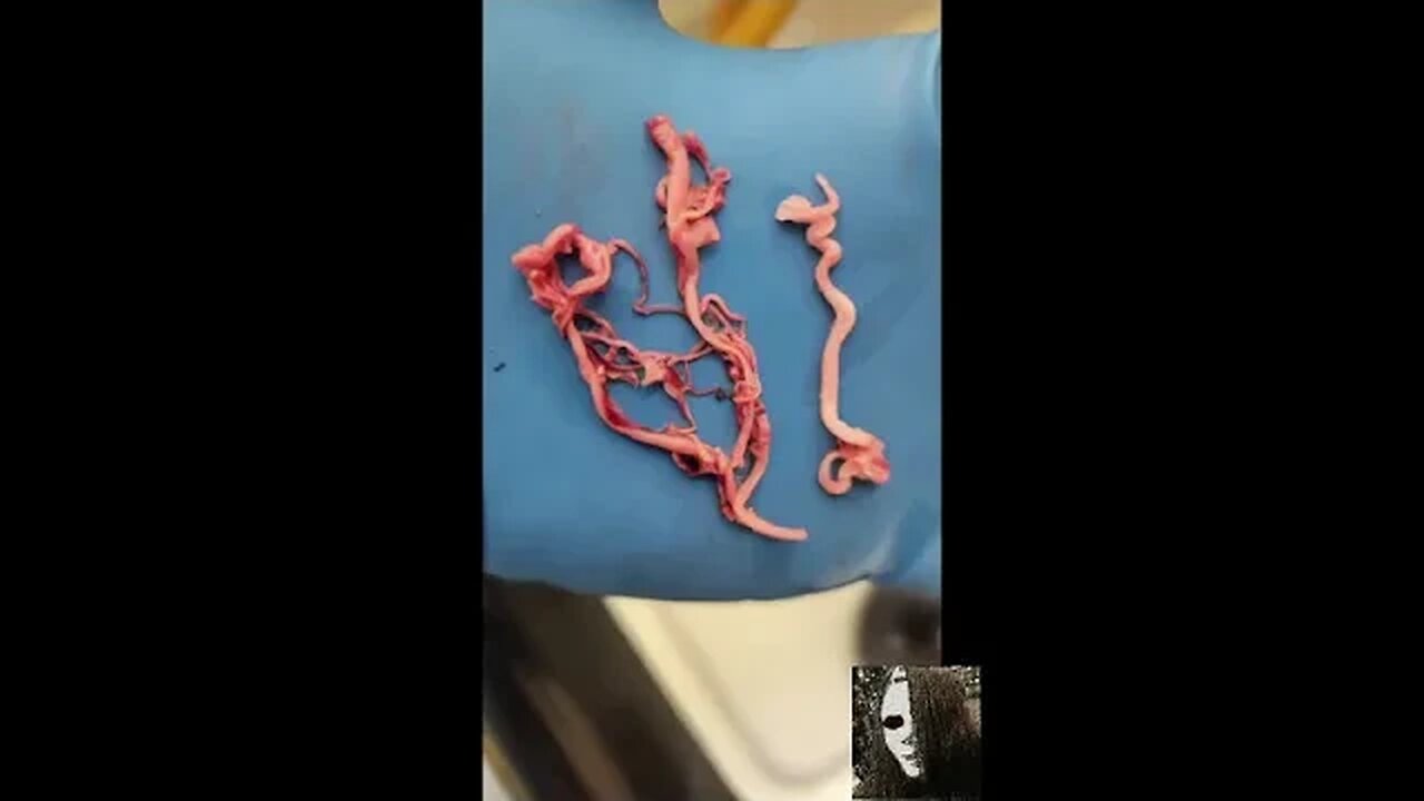 h̷̢̺͐̿̐̐͐̍̈a̵̧̙̟̹̗̎̽́͘̚r̷̪͖̖͌̓̓̔̆̊̈́̅v̵̢̛͕̮̺͓̬̒́̾̐̈́̚͠è̷͕̣̤͙̥̤̠̠̎̆̂̉s̶̢̔̀̉͑̒̇̈́̿t̷̮̮́͒͌̎̔̌͝