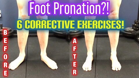 “Flat Feet/Duck Feet” *Foot OVERPRONATION* 6 BEST CORRECTIVE EXERCISES! | Dr Wil & Dr K