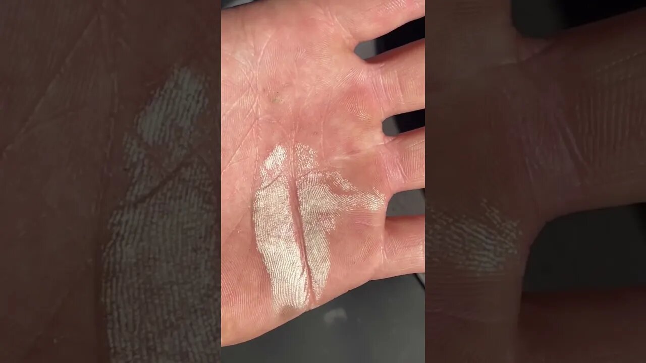 50% peroxide on the hand.