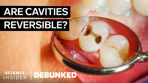 Dentists Debunk 15 More Teeth Myths