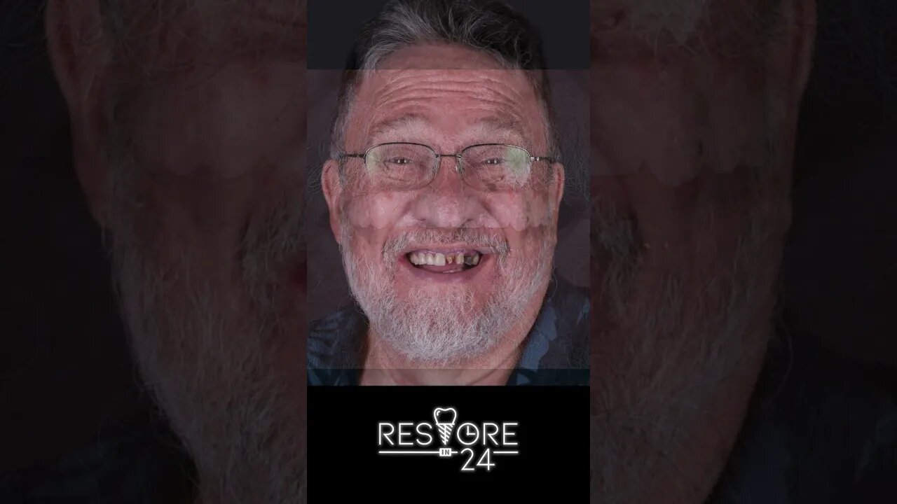 Tim S Restore in 24 Smile Makeover