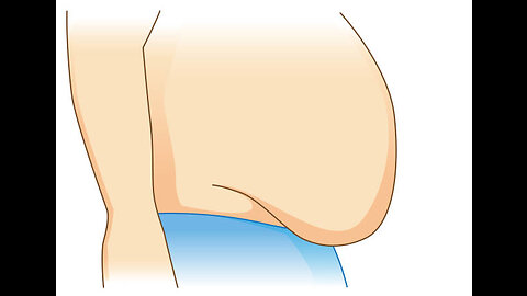 5 Minute Workout | Get Rid Of Chest Fat + Man Boobs In 20 Days