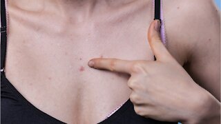 Chest acne: Why we get it and how to get rid of it