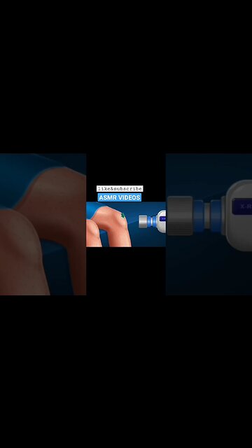 ASMR || Ankle Knee || Fracture treatment|| #shorts