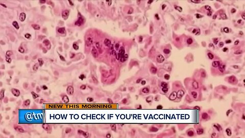 Not sure if you've been vaccinated for measles? Here's what to do