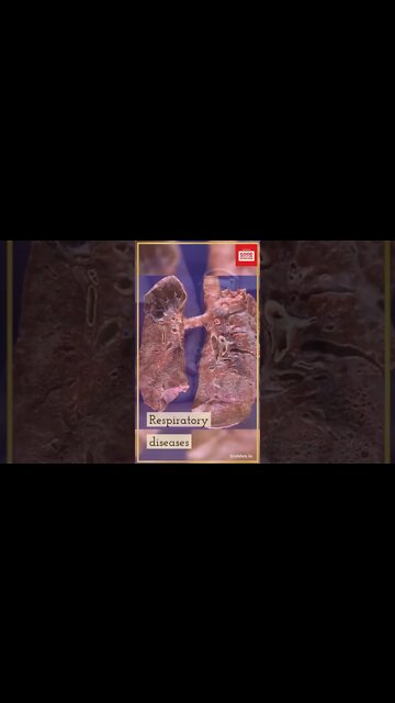 10 HEALTH BENEFITS OF EATING GINGER AND GARLIC TOGETHER #shorts