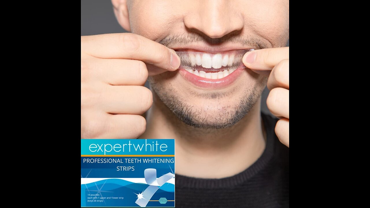 Amazing Crest 3D White Professional Effects Whitestrips Teeth Whitening Strips Kit 80 Count (Pa...