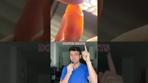 Finger becomes so swollen, bone is seen | Doctor Reacts