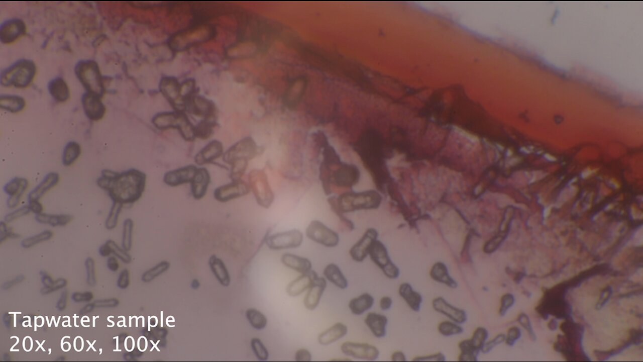 2022-10-07 Tapwater sample grams stain