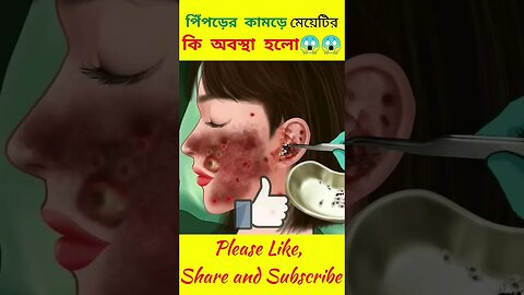 পিঁপড়ের কামড়ে মেয়েটির কি হলো😱 #shorts #youtubeshorts