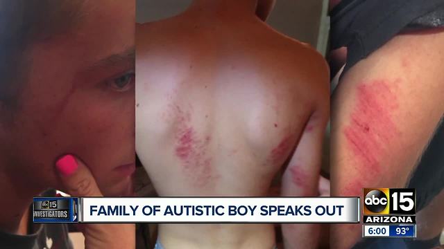 Valley mother speaks out after teen with autism detained by police