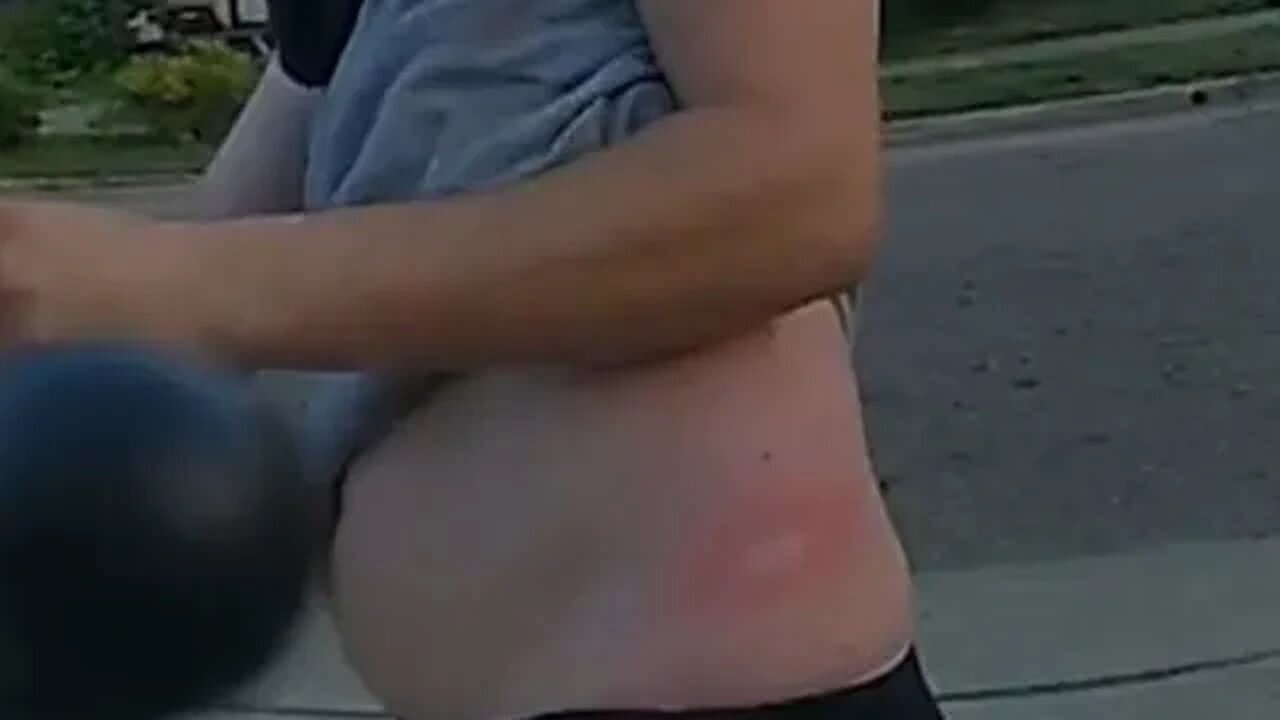 Standing up for myself and my family - YT stream from 7/11/2023 - Thumbnail is the proof of injury.