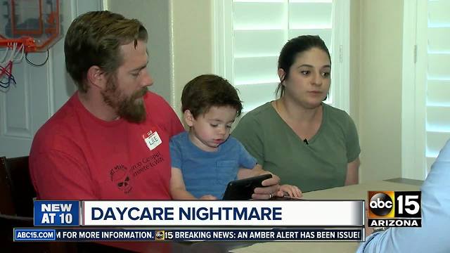 Parents outraged after child bitten multiple times at Glendale daycare