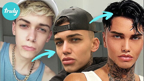 5 Face Surgeries In One Day - Everything Went Wrong | HOOKED ON THE LOOK