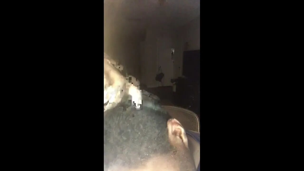 Asmr Dandruff Scratching