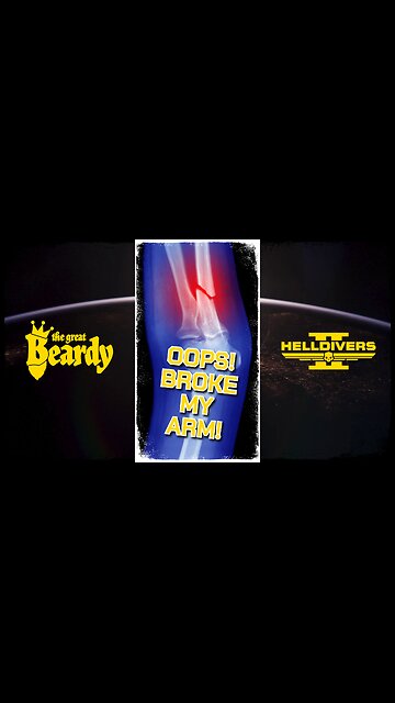 I BROKE MY ARM! // Beardy Highlights // Helldivers 2 // Short 14