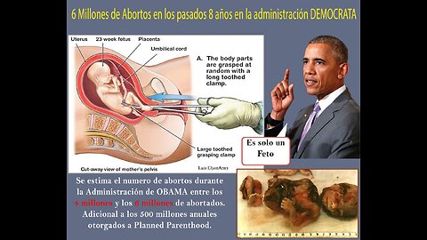 Intro Negocio de Abortos 2018