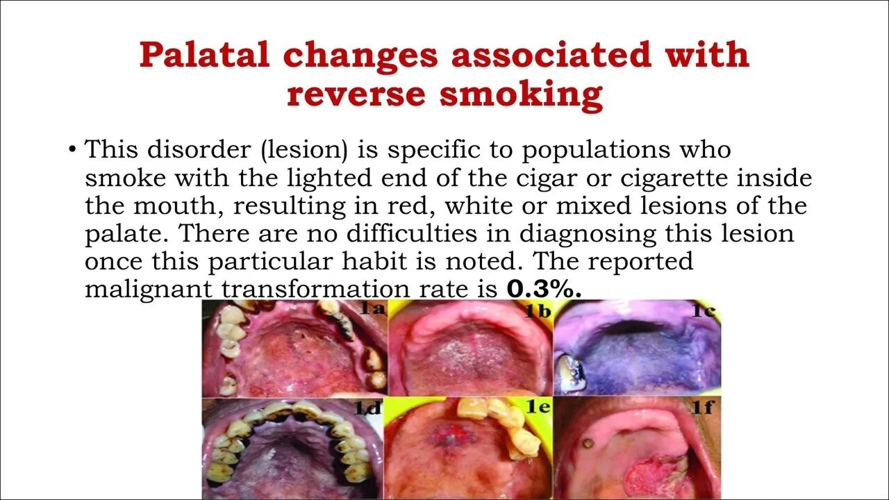 Oral surgery L10 (Premalignant Lesions)