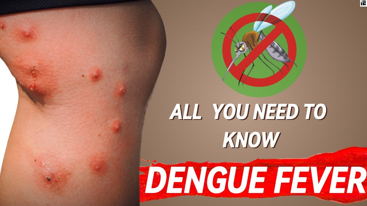 Everything to know on Dengue Fever