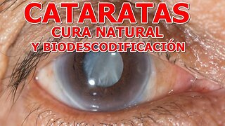 CURAR LAS CATARATAS DE FORMA NATURAL Y LA BIODESCODIFICACION