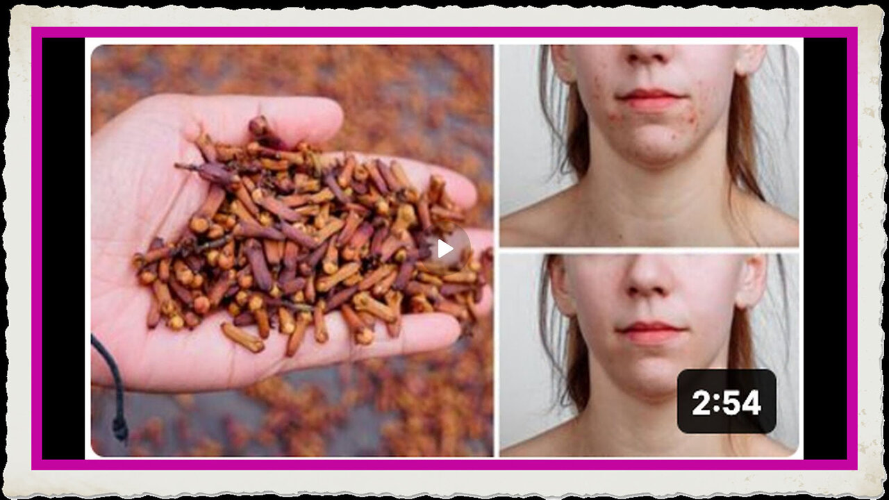 Start Consuming Cloves For Amazing Health Benefits