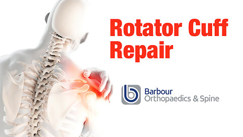 ROTATOR CUFF REPAIR