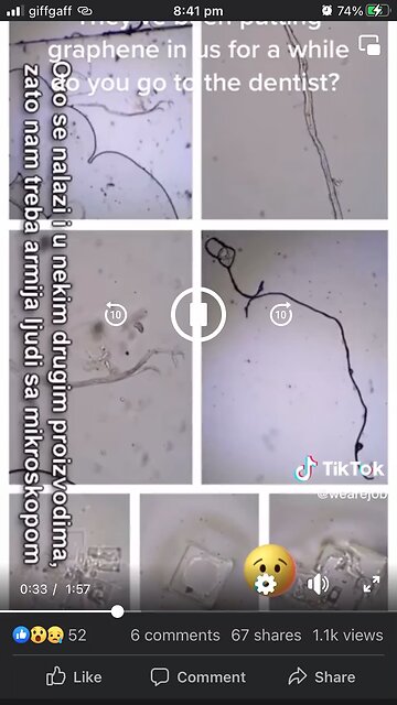 Graphene found everywhere even in dental anaesthetic injections