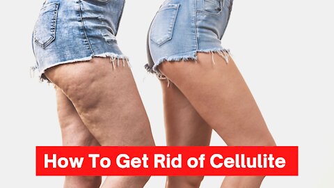 how to get rid of cellulite | how to remove cellulite fast