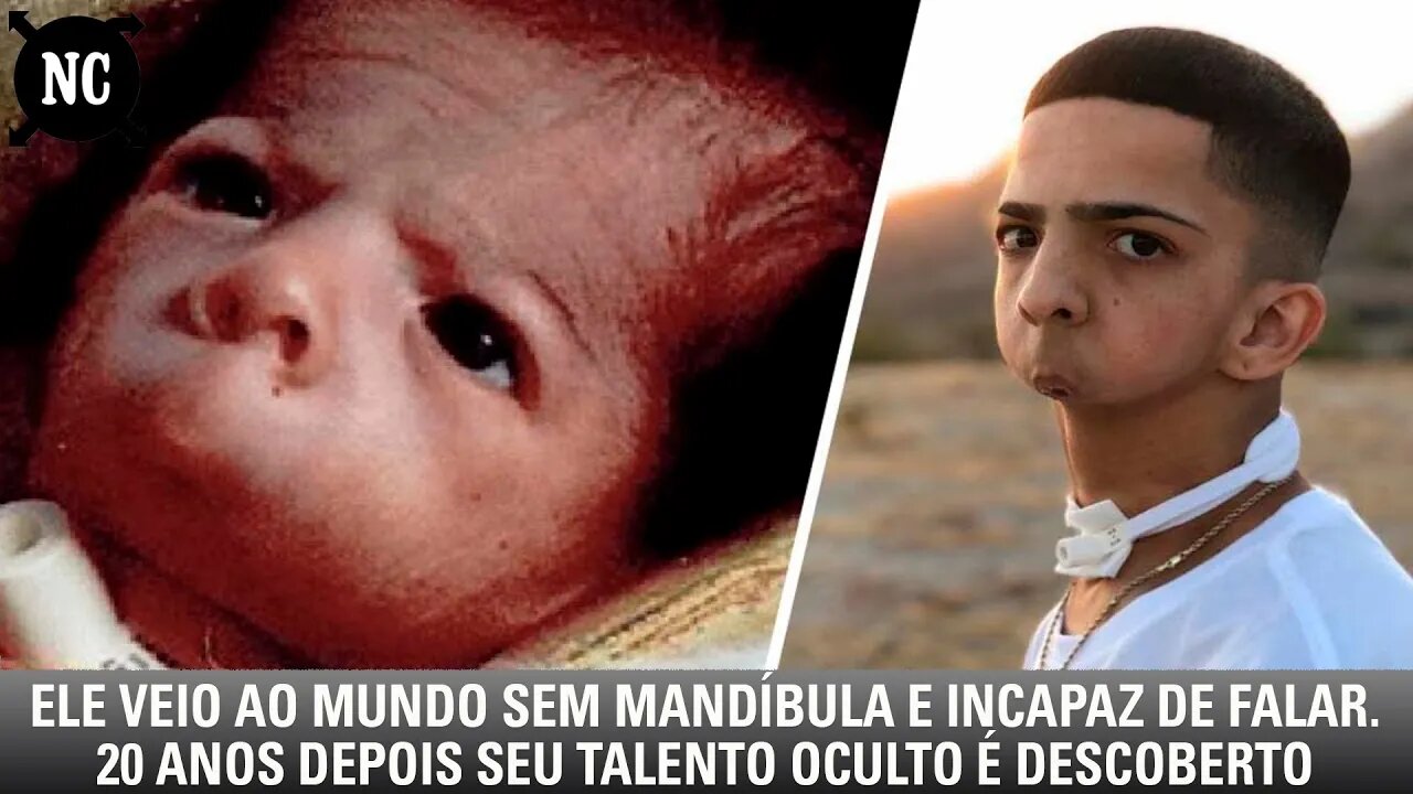 Ele Veio Ao Mundo Sem Mandíbula E Incapaz De Falar. 20 Anos Depois Seu Talento Oculto É Descoberto