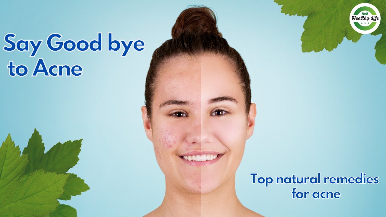 Clear Skin Secrets: Natural Remedies to Banish Acne Fast!