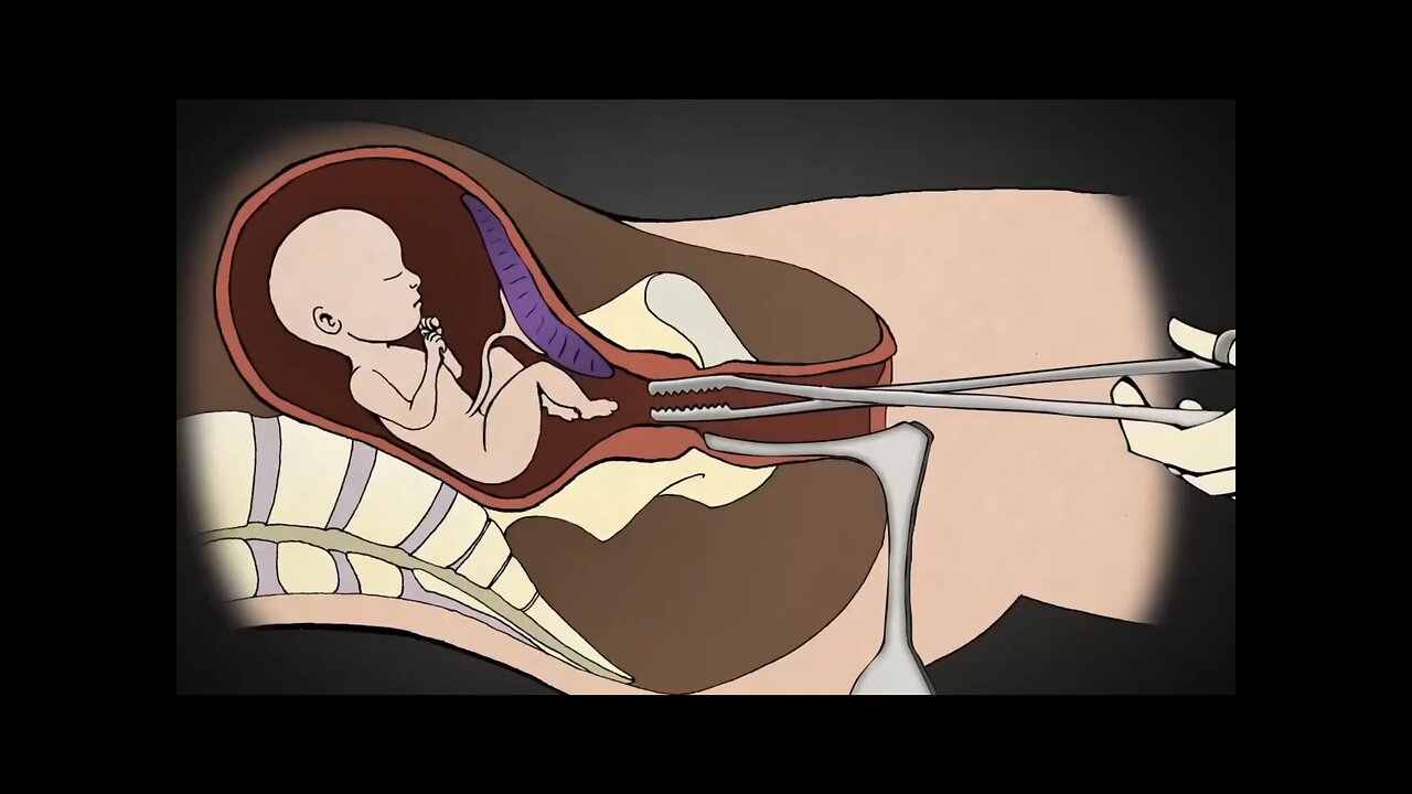 ABORTION🤰👩🍼🚼IS A CRIME AGAINST UNBORN BABIES👶CRIME AGAINST HUMANITY👨👩👧👦👫💫