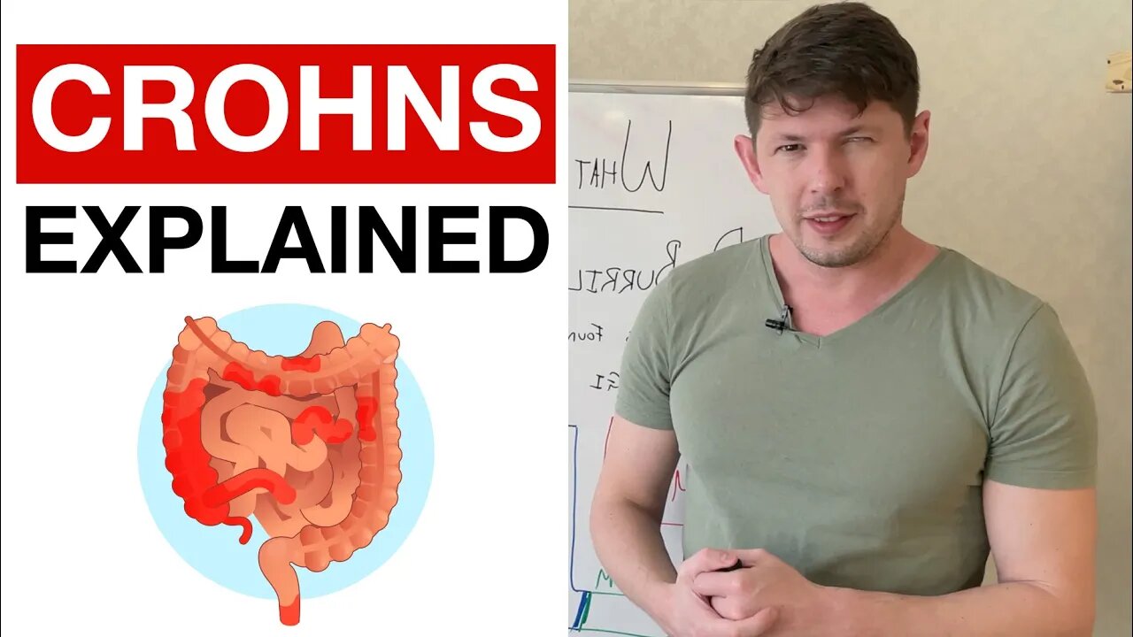 What is Crohn's Disease?