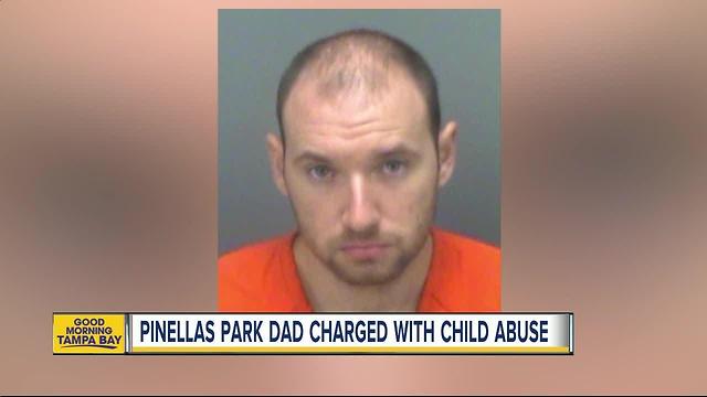 Father arrested for intentionally squeezing 1-month-old, fracturing several of the baby's ribs