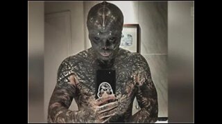 Homem amputa partes do corpo para se parecer com um alienigena - idelogia de Genero