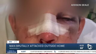 Man brutally attacked outside Mission Beach home