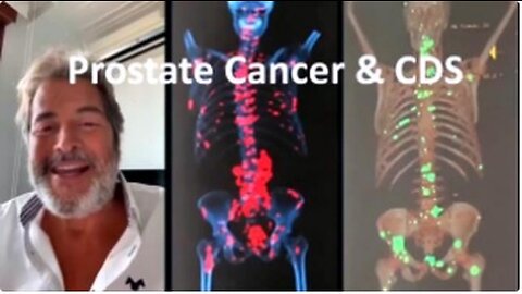 THE ILLUSTRATION OF PROSTATE CANCER RECOVERY THANKS TO CDS, CHLORINE DIOXIDE BY LUIS FELIPE LARAE