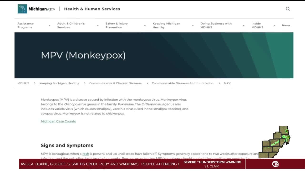 Michigan launches new website to provide updates and information on Monkeypox virus