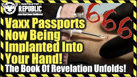 Yikes! Vaccine Passports Now Being Implanted Into Your Hand—The Book Of Revelation Unfolds!