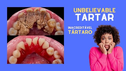 UNBELIEVABLE! HOW IS SO MUCH TARTARO POSSIBLE?