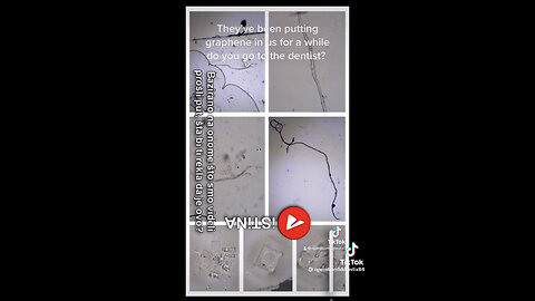 graphene oxide found in dental shots