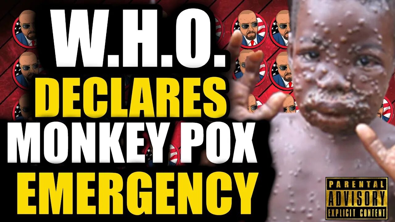 URGENT: Both the UN and America Have Declared Monkeypox a Public Health Emergency! Here We Go!