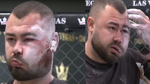 The Slap Heard Around The World