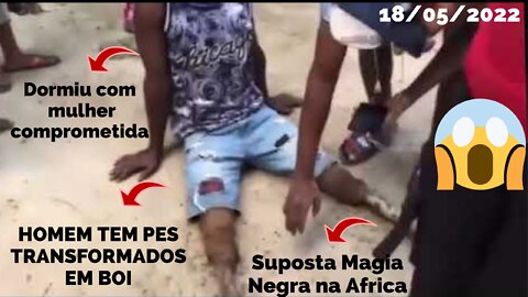 HOMEM TEM PES TRASNFORMADOS EM PE DE BOI POR MAGIA NEGRA NA ÁFRICA