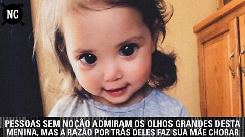 Pessoas sem noção admiram os olhos desta menina, mas a razão por trás deles deixa sua mãe em prantos