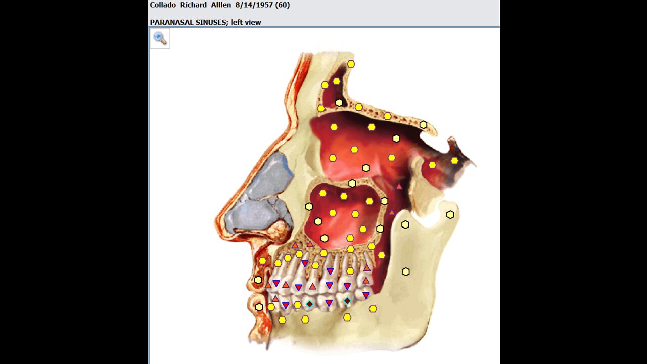 Bad Breath Natural Recovery Update Sun April 24th 2022