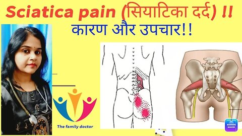 #Sciatica pain (#साइटिका दर्द) कारण और उपचार #homeopathy #pain #drminakshisingh