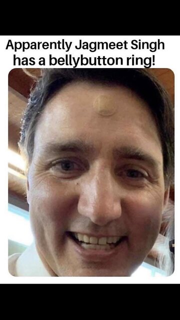 Jagmeet Sign gets burned on National TV