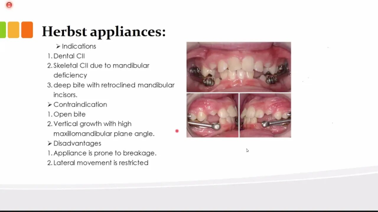 Orthodontics L16 (myofunctional appliances 2)